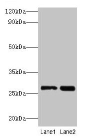 Western blot  | All lanes: LGALS3 antibody at 2µg/ml  | Lane 1: Hela whole cell lysate  | Lane 2: MCF-7 whole cell lysate  | Secondary  | Goat polyclonal to rabbit IgG at 1/10000 dilution  | Predicted band size: 27 kDa  | Observed band size: 27 kDa