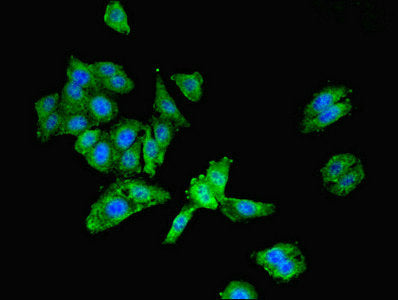 Immunofluorescent analysis of HepG2 cells using LGALS9 Antibody at dilution of 1:100 and Alexa Fluor 488-congugated AffiniPure Goat Anti-Rabbit IgG(H+L)Rabbit anti-Human LGALS9 Polyclonal Antibody