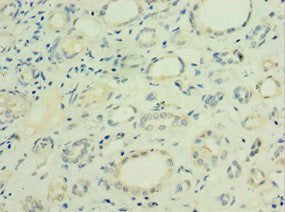 Immunohistochemistry of paraffin-embedded human kidney tissue using LGALS9 Antibody at dilution of 1:100Rabbit anti-Human LGALS9 Polyclonal Antibody