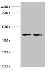 Western blot | All lanes: LGALS9 antibody at 14μg/ml | Lane 1: Hela whole cell lysate | Lane 2: Jurkat whole cell lysate | Secondary | Goat polyclonal to rabbit IgG at 1/10000 dilution | Predicted band size: 40, 36, 35, 27, 26, 39 kDa | Observed band size: 40 kDa