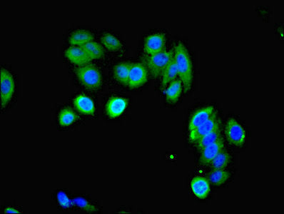 Immunofluorescent analysis of HepG2 cells using LHCGR Antibody at dilution of 1:100 and Alexa Fluor 488-congugated AffiniPure Goat Anti-Rabbit IgG(H+L)
