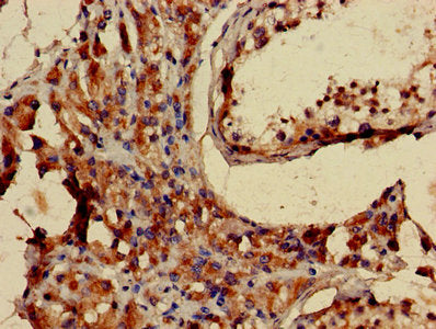 Immunohistochemistry of paraffin-embedded human testis tissue using LHCGR Antibody at dilution of 1:100