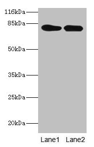 Western blot  | All lanes: LHCGR antibody at 2µg/ml  | Lane 1: Mouse brain tissue  | Lane 2: Mouse kidney tissue  | Secondary  | Goat polyclonal to rabbit IgG at 1/10000 dilution  | Predicted band size: 79, 72 kDa  | Observed band size: 79 kDa