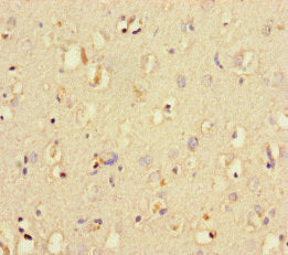 Immunohistochemistry of paraffin-embedded human brain tissue using LIG3 Antibody at dilution of 1:100