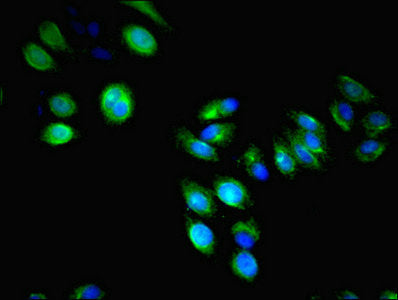 Immunofluorescent analysis of HepG2 cells using LILRA4 Antibody at dilution of 1:100 and Alexa Fluor 488-congugated AffiniPure Goat Anti-Rabbit IgG(H+L)
