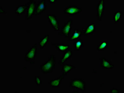 Immunofluorescence staining of SH-SY5Y cells with LIMD2 Antibody at 1:167, counter-stained with DAPI. The cells were fixed in 4% formaldehyde, permeabilized using 0.2% Triton X-100 and blocked in 10% normal Goat Serum. The cells were then incubated with the antibody overnight at 4°C. The secondary antibody was Alexa Fluor 488-congugated AffiniPure Goat Anti-Rabbit IgG(H+L).