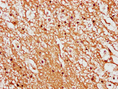 IHC image of LIMD2 Antibody diluted at 1:500 and staining in paraffin-embedded human brain tissue performed on a Leica BondTM system. After dewaxing and hydration, antigen retrieval was mediated by high pressure in a citrate buffer (pH 6.0). Section was blocked with 10% normal goat serum 30min at RT. Then primary antibody (1% BSA) was incubated at 4°C overnight. The primary is detected by a biotinylated secondary antibody and visualized using an HRP conjugated SP system.