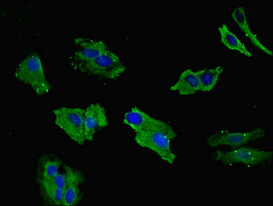 Immunofluorescent analysis of Hela cells using LIMS1 Antibody at dilution of 1:100 and Alexa Fluor 488-congugated AffiniPure Goat Anti-Rabbit IgG(H+L)