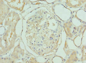 Immunohistochemistry of paraffin-embedded human kidney tissue using LIMS1 Antibody at dilution of 1:100