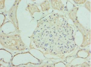 Immunohistochemistry of paraffin-embedded human kidney tissue using LIMS1 Antibody at dilution of 1:100