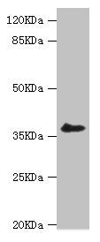 Western blot | All lanes: LIMS1 antibody at 0.93μg/ml + A549 whole cell lysate | Secondary | Goat polyclonal to rabbit IgG at 1/10000 dilution | Predicted band size: 38, 39, 45, 42 kDa | Observed band size: 38 kDa