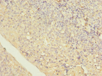 Immunohistochemistry of paraffin-embedded human tonsil tissue using LITAF Antibody at dilution of 1:100