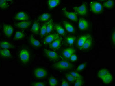 Immunofluorescence staining of A549 cells with LMAN1 Antibody at 1:100, counter-stained with DAPI. The cells were fixed in 4% formaldehyde, permeabilized using 0.2% Triton X-100 and blocked in 10% normal Goat Serum. The cells were then incubated with the antibody overnight at 4°C. The secondary antibody was Alexa Fluor 488-congugated AffiniPure Goat Anti-Rabbit IgG(H+L).