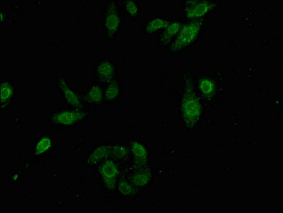 Immunofluorescence staining of HepG2 cells with LMNA Antibody at 1:100, counter-stained with DAPI. The cells were fixed in 4% formaldehyde, permeabilized using 0.2% Triton X-100 and blocked in 10% normal Goat Serum. The cells were then incubated with the antibody overnight at 4°C. The secondary antibody was Alexa Fluor 488-congugated AffiniPure Goat Anti-Rabbit IgG(H+L).