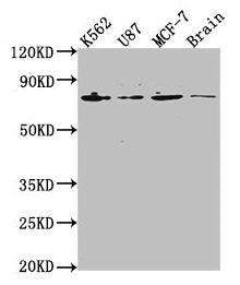 Western Blot | Positive WB detected in: K562 whole cell lysate, U87 whole cell lysate, MCF-7 whole cell lysate, Rat brain tissue | All lanes: LMNA antibody at 1:2000 | Secondary | Goat polyclonal to rabbit IgG at 1/50000 dilution | Predicted band size: 75, 66, 71, 64, 63, 70 kDa | Observed band size: 75 kDa