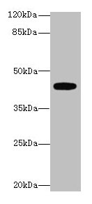Western blot  | All lanes: LPAR4 antibody at 4µg/ml + Mouse kidney tissue  | Secondary  | Goat polyclonal to rabbit IgG at 1/10000 dilution  | Predicted band size: 42 kDa  | Observed band size: 42 kDa