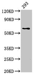 Western Blot | Positive WB detected in: 293 whole cell lysate | All lanes: LPCAT2 antibody at 5μg/ml | Secondary | Goat polyclonal to rabbit IgG at 1/50000 dilution | Predicted band size: 61, 31 kDa | Observed band size: 61 kDa
