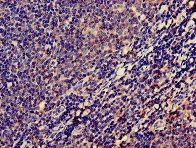 Immunohistochemistry of paraffin-embedded human lymph node tissue using LPXN Antibody at dilution of 1:100