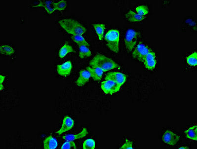 Immunofluorescent analysis of MCF-7 cells using LRBA Antibody at dilution of 1:100 and Alexa Fluor 488-congugated AffiniPure Goat Anti-Rabbit IgG(H+L)
