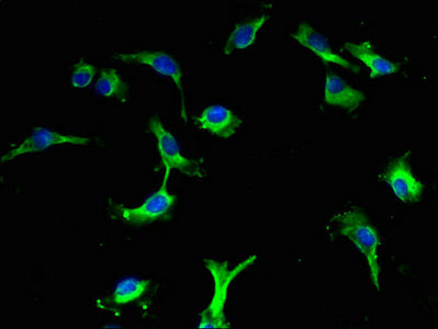 Immunofluorescent analysis of U251 cells using LRBA Antibody at dilution of 1:100 and Alexa Fluor 488-congugated AffiniPure Goat Anti-Rabbit IgG(H+L)