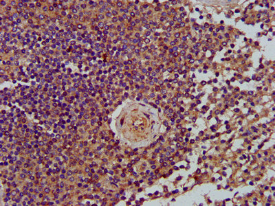 IHC image of LRPPRC Antibody diluted at 1:400 and staining in paraffin-embedded human spleen tissue performed on a Leica BondTM system. After dewaxing and hydration, antigen retrieval was mediated by high pressure in a citrate buffer (pH 6.0). Section was blocked with 10% normal goat serum 30min at RT. Then primary antibody (1% BSA) was incubated at 4°C overnight. The primary is detected by a biotinylated secondary antibody and visualized using an HRP conjugated SP system.