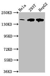 Western Blot  | Positive WB detected in: Hela whole cell lysate, 293T whole cell lysate, HepG2 whole cell lysate  | All lanes: LRPPRC antibody at 4µg/ml  | Secondary  | Goat polyclonal to rabbit IgG at 1/50000 dilution  | Predicted band size: 158 kDa  | Observed band size: 158 kDa
