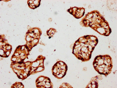 IHC image of CSNK1E Antibody diluted at 1:150 and staining in paraffin-embedded human placenta tissue performed on a Leica BondTM system. After dewaxing and hydration, antigen retrieval was mediated by high pressure in a citrate buffer (pH 6.0). Section was blocked with 10% normal goat serum 30min at RT. Then primary antibody (1% BSA) was incubated at 4°C overnight. The primary is detected by a biotinylated secondary antibody and visualized using an HRP conjugated SP system.Rabbit anti-Human CSNK1E Polyclonal Antibody