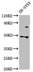 Western Blot  | Positive WB detected in: SH-SY5Y whole cell lysate  | All lanes: CSNK1E antibody at 3µg/ml  | Secondary  | Goat polyclonal to rabbit IgG at 1/50000 dilution  | Predicted band size: 48 kDa  | Observed band size: 48 kDaRabbit anti-Human CSNK1E Polyclonal Antibody