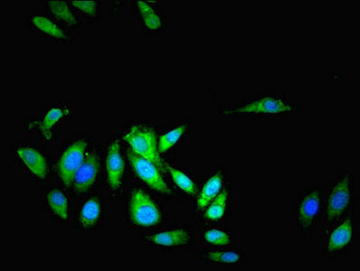 Immunofluorescent analysis of Hela cells using LRRFIP1 Antibody at dilution of 1:100 and Alexa Fluor 488-congugated AffiniPure Goat Anti-Rabbit IgG(H+L)
