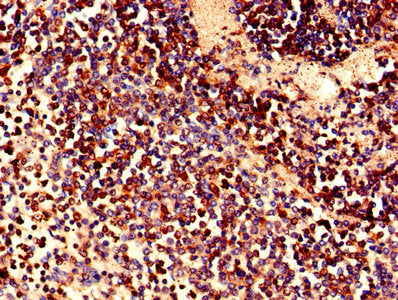 Immunohistochemistry of paraffin-embedded human spleen tissue using LRRFIP1 Antibody at dilution of 1:100