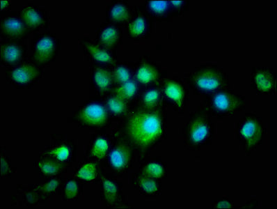 Immunofluorescence staining of Hela cells with CSNK1E Antibody at 1:266, counter-stained with DAPI. The cells were fixed in 4% formaldehyde, permeabilized using 0.2% Triton X-100 and blocked in 10% normal Goat Serum. The cells were then incubated with the antibody overnight at 4°C. The secondary antibody was Alexa Fluor 488-congugated AffiniPure Goat Anti-Rabbit IgG(H+L).Rabbit anti-Human CSNK1E Polyclonal Antibody