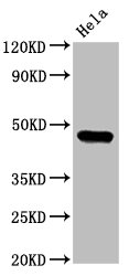 Western Blot  | Positive WB detected in: Hela whole cell lysate  | All lanes: CSNK1E antibody at 3.2µg/ml  | Secondary  | Goat polyclonal to rabbit IgG at 1/50000 dilution  | Predicted band size: 48 kDa  | Observed band size: 48 kDaRabbit anti-Human CSNK1E Polyclonal Antibody
