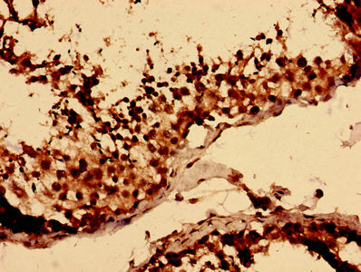 Immunohistochemistry analysis of human testis tissue using the antibody at dilution of 1:100