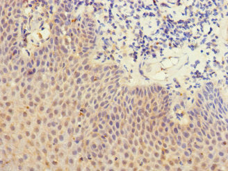 Immunohistochemistry of paraffin-embedded human tonsil tissue using LY75 Antibody at dilution of 1:100
