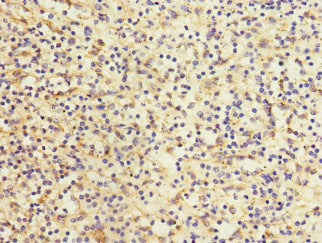 Immunohistochemistry of paraffin-embedded human spleen tissue using LY75 Antibody at dilution of 1:100