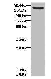 Western blot | All lanes: LY75 antibody IgG at 1.57μg/ml + Mouse liver tissue | Secondary | Goat polyclonal to rabbit IgG at 1/10000 dilution | Predicted band size: 199, 216, 20, 210 kDa | Observed band size: 199 kDa