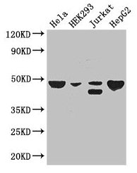 Western Blot  | Positive WB detected in: Hela whole cell lysate, HEK293 whole cell lysate, Jurkat whole cell lysate, HepG2 whole cell lysate  | All lanes: PLIN3 antibody at 3µg/ml  | Secondary  | Goat polyclonal to rabbit IgG at 1/50000 dilution  | Predicted band size: 48, 29, 47, 46 kDa  | Observed band size: 48, 46 kDaRabbit anti-Human PLIN3 Polyclonal Antibody