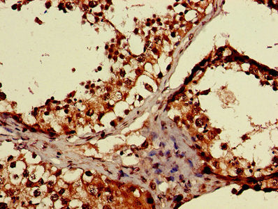 IHC image of MAEA Antibody diluted at 1:600 and staining in paraffin-embedded human testis tissue performed on a Leica BondTM system. After dewaxing and hydration, antigen retrieval was mediated by high pressure in a citrate buffer (pH 6.0). Section was blocked with 10% normal goat serum 30min at RT. Then primary antibody (1% BSA) was incubated at 4°C overnight. The primary is detected by a biotinylated secondary antibody and visualized using an HRP conjugated SP system.