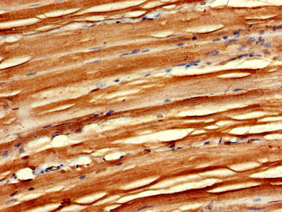 IHC image of MAEA Antibody diluted at 1:600 and staining in paraffin-embedded human skeletal muscle tissue performed on a Leica BondTM system. After dewaxing and hydration, antigen retrieval was mediated by high pressure in a citrate buffer (pH 6.0). Section was blocked with 10% normal goat serum 30min at RT. Then primary antibody (1% BSA) was incubated at 4°C overnight. The primary is detected by a biotinylated secondary antibody and visualized using an HRP conjugated SP system.
