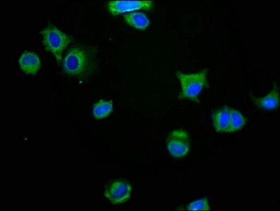 Immunofluorescence staining of MCF-7 cells with the antibody at 1:200, counter-stained with DAPI. The cells were fixed in 4% formaldehyde, permeabilized using 0.2% Triton X-100 and blocked in 10% normal Goat Serum. The cells were then incubated with the antibody overnight at 4°C. The secondary antibody was Alexa Fluor 488-congugated AffiniPure Goat Anti-Rabbit IgG(H+L).