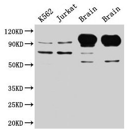 Western Blot  | Positive WB detected in: K562 whole cell lysate, Jurkat whole cell lysate, Rat brain tissue, Mouse brain tissue  | All lanes: MAG antibody at 5µg/ml  | Secondary  | Goat polyclonal to rabbit IgG at 1/50000 dilution  | Predicted band size: 70, 64, 67 kDa  | Observed band size: 70, 100 kDa