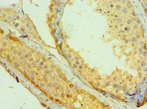 Immunohistochemistry of paraffin-embedded human testis tissue using MAGEA1 Antibody at dilution of 1:100