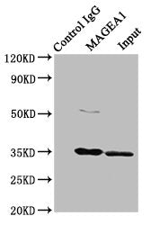 Immunoprecipitating MAGEA1 in Hela whole cell lysate  | Lane 1: Rabbit control IgG instead of MAGEA1 Antibody in Hela whole cell lysate. For western blotting, a HRP-conjugated Protein G antibody was used as the secondary antibody (1/2000)  | Lane 2: MAGEA1 Antibody (8µg) + Hela whole cell lysate (500µg)  | Lane 3: Hela whole cell lysate (10µg)