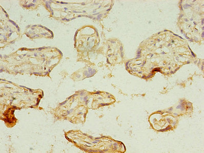 Immunohistochemistry of paraffin-embedded human placenta tissue using MAGEA10 Antibody at dilution of 1:100