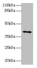 Western blot  | All lanes: MAGEA10 antibody at 2µg/ml + HL60 whole cell lysate  | Secondary  | Goat polyclonal to rabbit IgG at 1/10000 dilution  | Predicted band size: 41 kDa  | Observed band size: 41 kDa