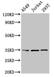 Western Blot  | Positive WB detected in: A549 whole cell lysate, Jurkat whole cell lysate, 293T whole cell lysate  | All lanes: MAGEA3 antibody at 4µg/ml  | Secondary  | Goat polyclonal to rabbit IgG at 1/50000 dilution  | Predicted band size: 35 kDa  | Observed band size: 35 kDa