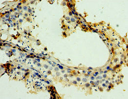 Immunohistochemistry of paraffin-embedded human testis tissue using MAGEA6 Antibody at dilution of 1:100