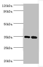 Western blot | All lanes: MAGEA6 antibody at 7μg/ml | Lane 1: Rat brain tissue | Lane 2: Rat gonad tissue | Secondary | Goat polyclonal to rabbit IgG at 1/10000 dilution | Predicted band size: 35 kDa | Observed band size: 35 kDa