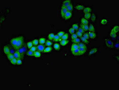 Immunofluorescent analysis of PC-3 cells using MAGEA8 Antibody at dilution of 1:100 and Alexa Fluor 488-congugated AffiniPure Goat Anti-Rabbit IgG(H+L)