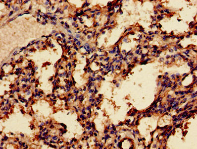 Immunohistochemistry of paraffin-embedded human lung tissue using MAGEA8 Antibody at dilution of 1:100